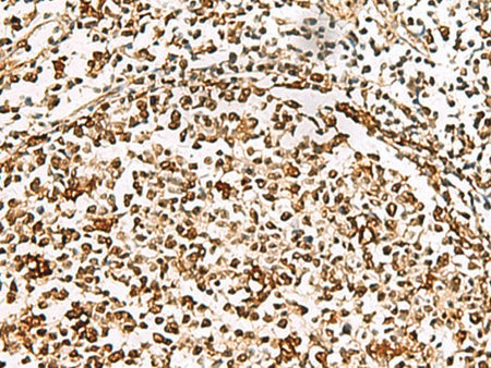 XRCC4 Polyclonal Antibody Reactivity Human
