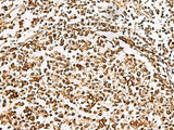 XRCC4 Polyclonal Antibody Reactivity Human