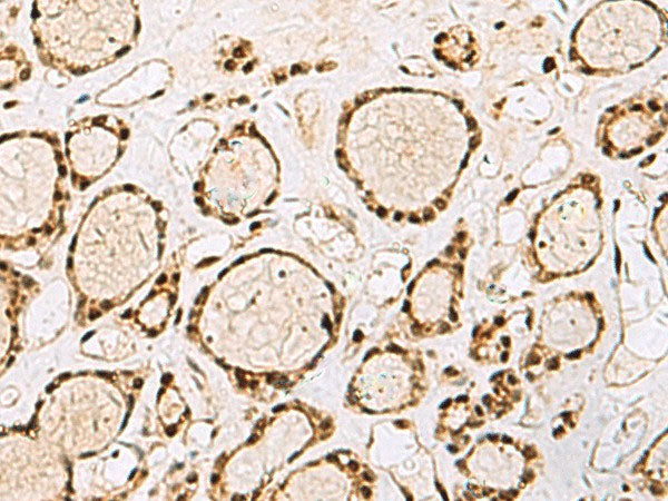 XRCC4 Polyclonal Antibody Reactivity Human