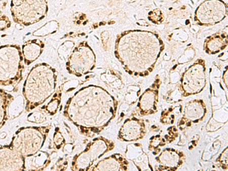 XRCC4 Polyclonal Antibody Reactivity Human