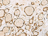 XRCC4 Polyclonal Antibody Reactivity Human