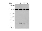 MORC2 Polyclonal Antibody Reactivity Human