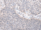 ZNF239 Polyclonal Antibody