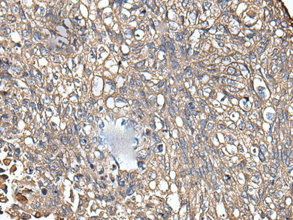 KRT73 Polyclonal Antibody