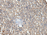KRT73 Polyclonal Antibody