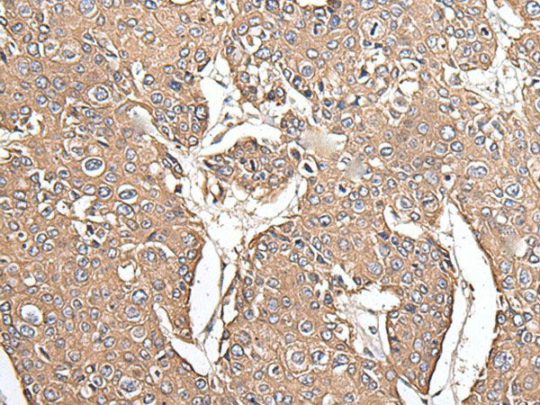 KRT73 Polyclonal Antibody