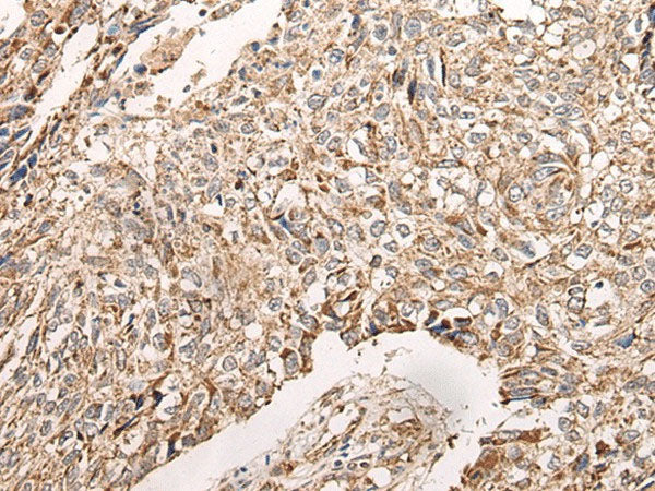 NDUFB11 Polyclonal Antibody Reactivity Mouse