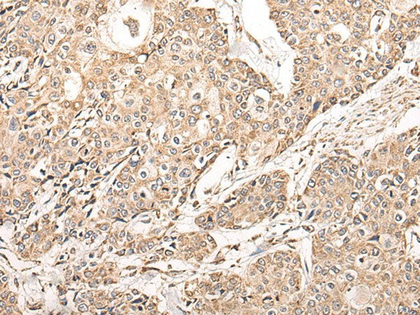 NDUFB11 Polyclonal Antibody Reactivity Mouse