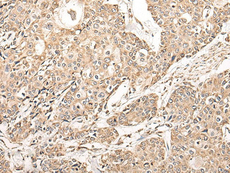 NDUFB11 Polyclonal Antibody Reactivity Mouse