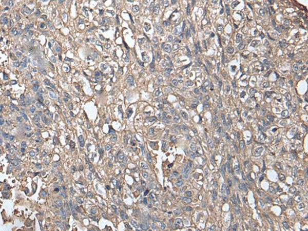NDUFB5 Polyclonal Antibody Reactivity Human