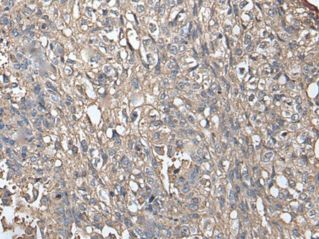 NDUFB5 Polyclonal Antibody Reactivity Human