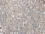 NDUFB5 Polyclonal Antibody Reactivity Human