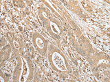 FNDC3B Polyclonal Antibody