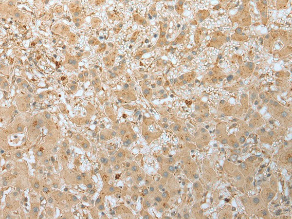 FNDC3B Polyclonal Antibody