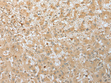 FNDC3B Polyclonal Antibody