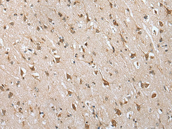 HIF1A Polyclonal Antibody