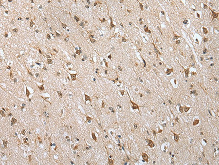 HIF1A Polyclonal Antibody