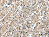 HIF1A Polyclonal Antibody