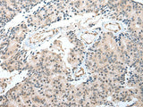 S100A16 Polyclonal Antibody