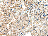 S100A16 Polyclonal Antibody