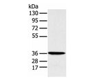 MAT2B Polyclonal Antibody Reactivity Human