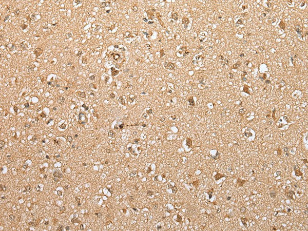 ATXN7L3 Polyclonal Antibody Reactivity Mouse