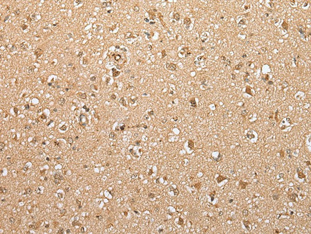 ATXN7L3 Polyclonal Antibody Reactivity Mouse