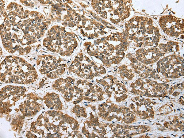 ATXN7L3 Polyclonal Antibody Reactivity Mouse