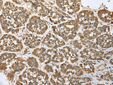 ATXN7L3 Polyclonal Antibody Reactivity Mouse