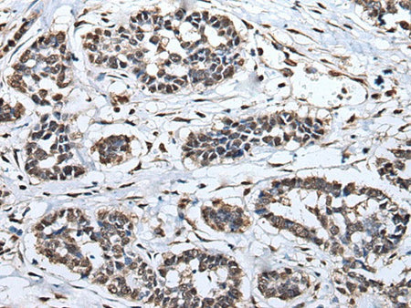 HNRNPH2 Polyclonal Antibody Reactivity Human