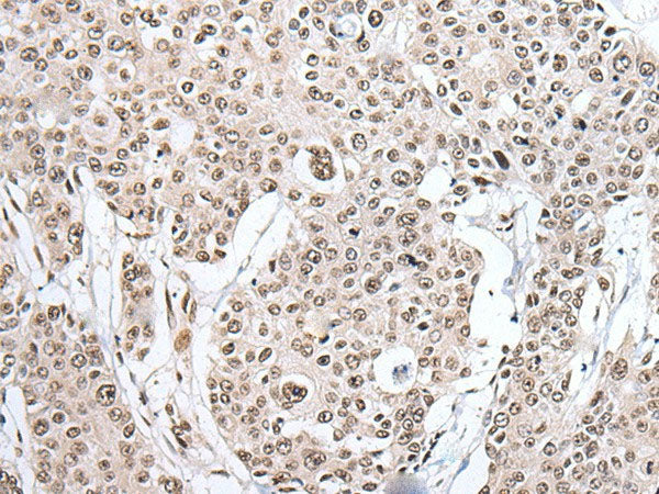 HNRNPH2 Polyclonal Antibody Reactivity Human