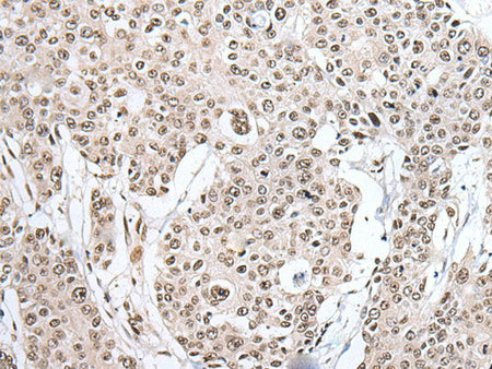 HNRNPH2 Polyclonal Antibody Reactivity Human