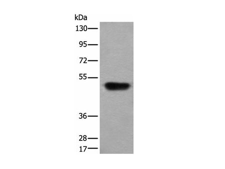 HNRNPH2 Polyclonal Antibody Reactivity Human