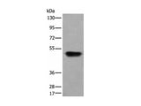 HNRNPH2 Polyclonal Antibody Reactivity Human