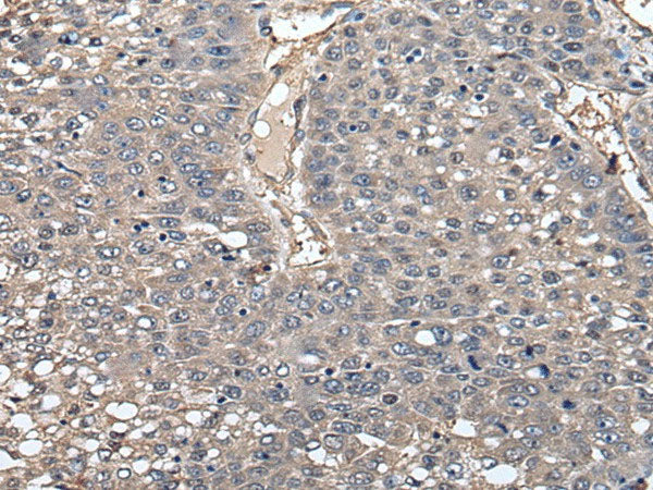 GCNT2 Polyclonal Antibody Reactivity Human