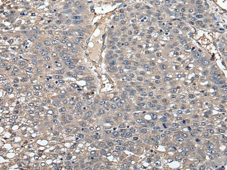 GCNT2 Polyclonal Antibody Reactivity Human
