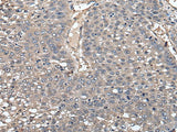 GCNT2 Polyclonal Antibody Reactivity Human