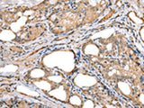 LRRC19 Polyclonal Antibody