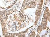 LRRC19 Polyclonal Antibody