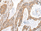 KCTD16 Polyclonal Antibody Reactivity Mouse