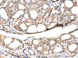 KCTD16 Polyclonal Antibody Reactivity Mouse