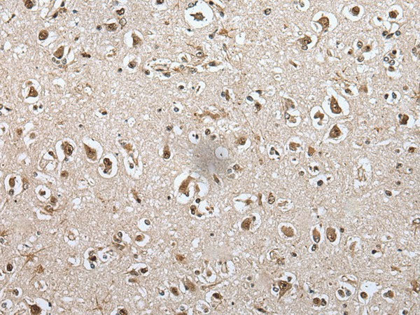 METAP1D Polyclonal Antibody Reactivity Mouse