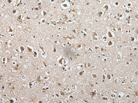 METAP1D Polyclonal Antibody Reactivity Mouse