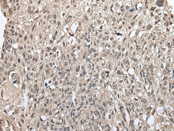 METAP1D Polyclonal Antibody Reactivity Mouse