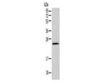 HIST1H1T Polyclonal Antibody