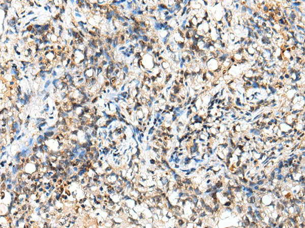 NUDT18 Polyclonal Antibody