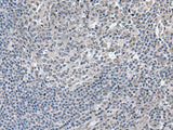 EDARADD Polyclonal Antibody Reactivity Human