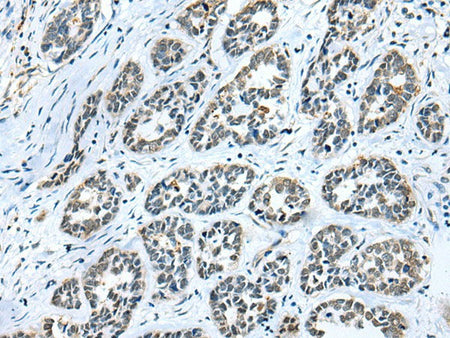 GMFB Polyclonal Antibody