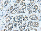 GMFB Polyclonal Antibody