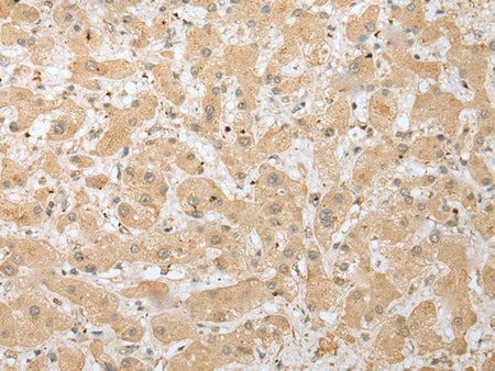 DHRSX Polyclonal Antibody